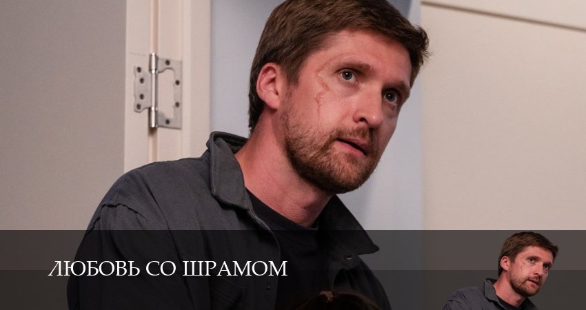 Любовь со шрамом (1 сезон, 1-10,11,12 серия) сериал 2025 смотреть