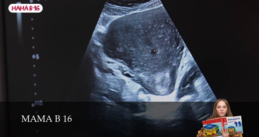 Сериал Мама в 16 (2025) 4 сезон 9 серия в 4K UHD и HD смотреть онлайн бесплатно